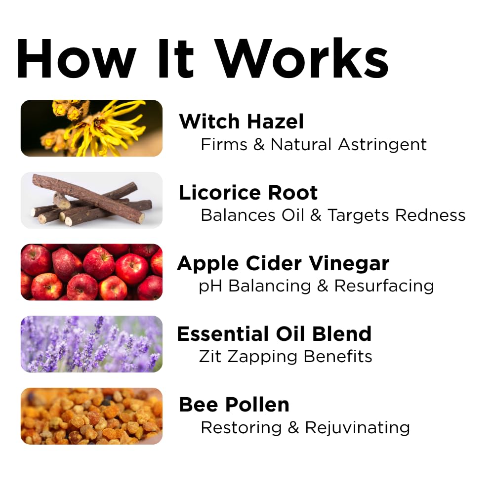 Sumbody Acne Serum for Face Zit Zapper - Blemish Pimple Reducer Women Men Teens, Facial Serum Acne Scars, Red Spot Remover & Pore Reducer Roll-On Beauty & Personal Care Sumbody