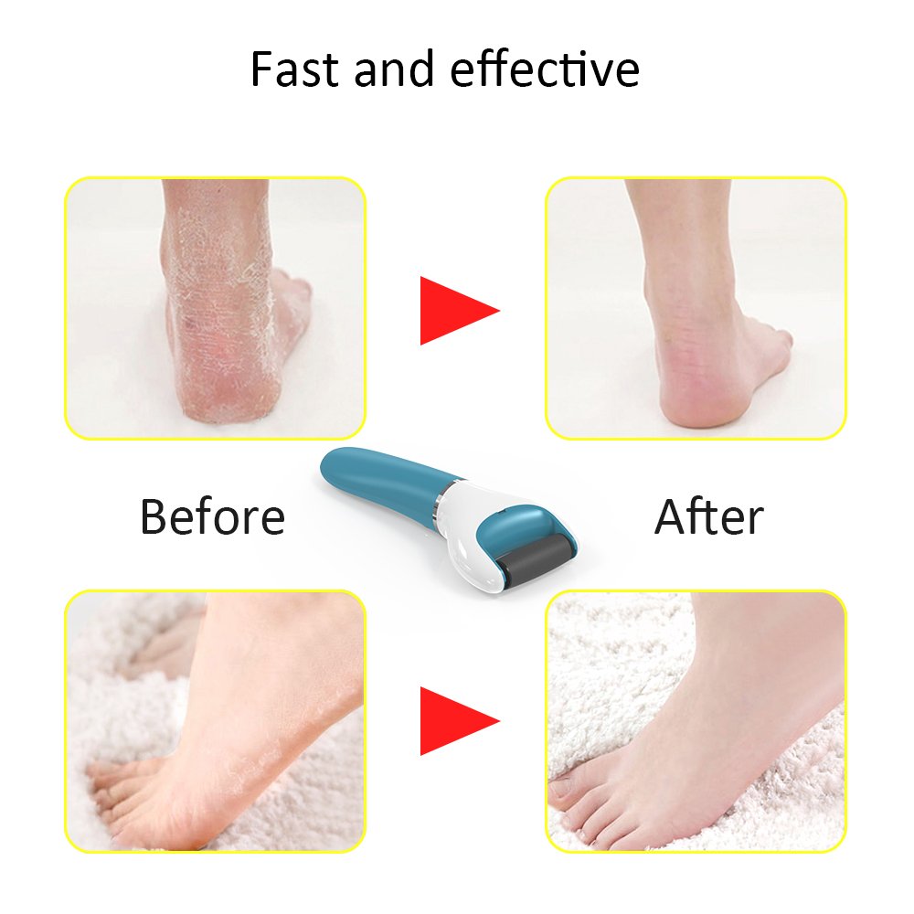 Electric Foot File Callus Remover Professional, 2-Speed Rechargeable Pedicure Tool for Remove Calluses, Dry, Hard, Dead, Cracked Skin, Includes 2 Beauty & Personal Care Pretfy