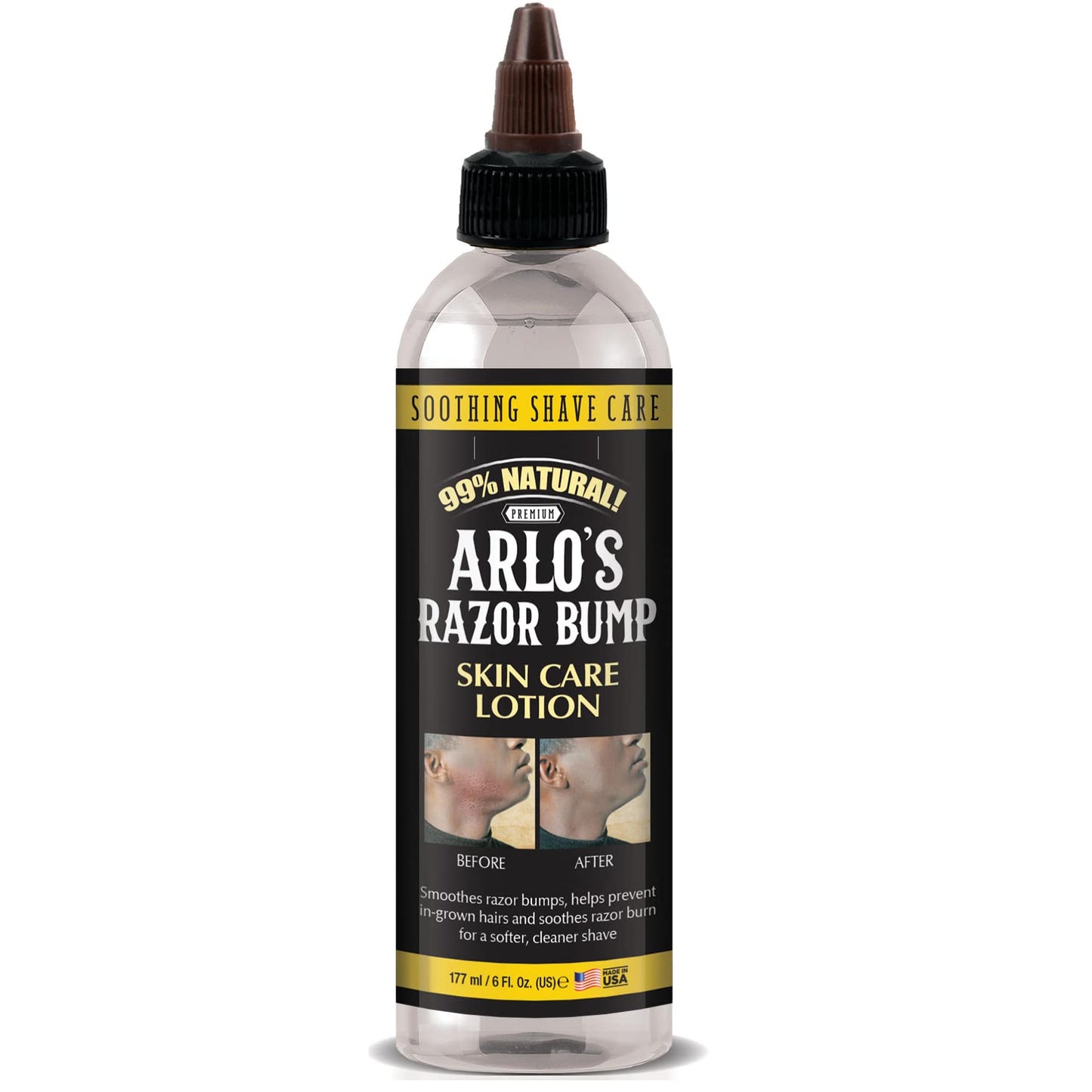 Arlo's Razor Bump Skin Care Lotion 6 oz. Beauty & Personal Care Arlo's