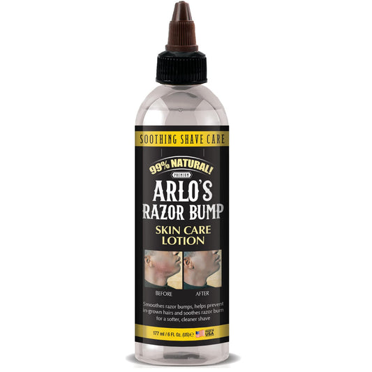 Arlo's Razor Bump Skin Care Lotion 6 oz. Beauty & Personal Care Arlo's