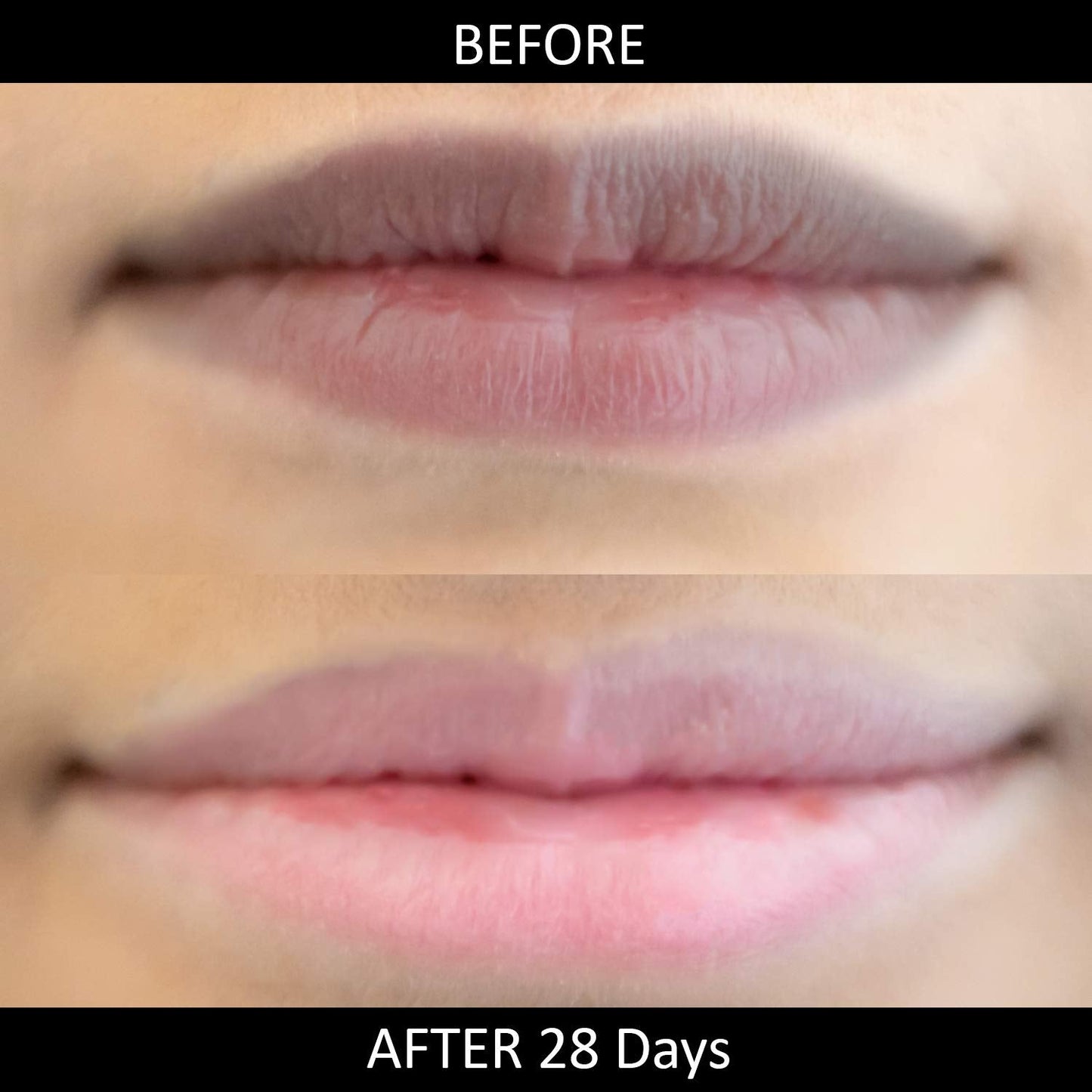 Lip Lightening Stick for Dark Lips by Omorfee - Lip Balm for Dry Lips, Smokers & Non-Smokers - Helps Reduce Lip Discoloration - Natural Protection Beauty and Personal Care OMORFEE BE EXOTIC OF