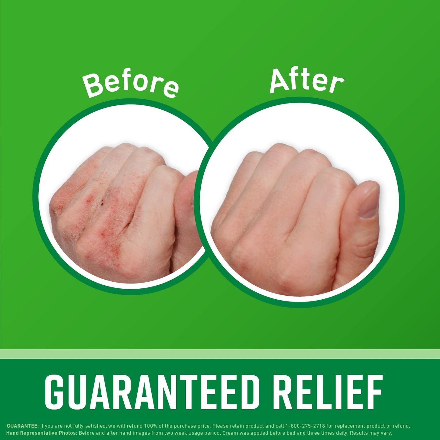 O'Keeffe's Working Hands Hand Cream (3.4 oz Jar) and Healthy Feet Foot Cream (3.2 oz Jar) - Repairing Skincare for Extremely Dry, Cracked Hands Beauty & Personal Care O'Keeffe's
