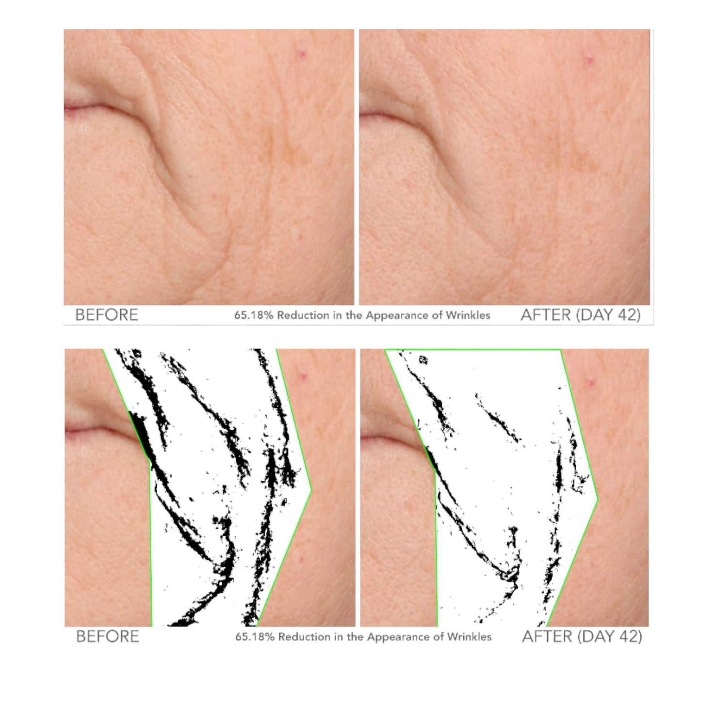 Serious Skincare - Beyond Intensive Vitamin C Serum for Face - 60 Day Facial Treatment for Healthy Glowing Skin and Brightening - Smoothes Lines Beauty & Personal Care Serious Skincare