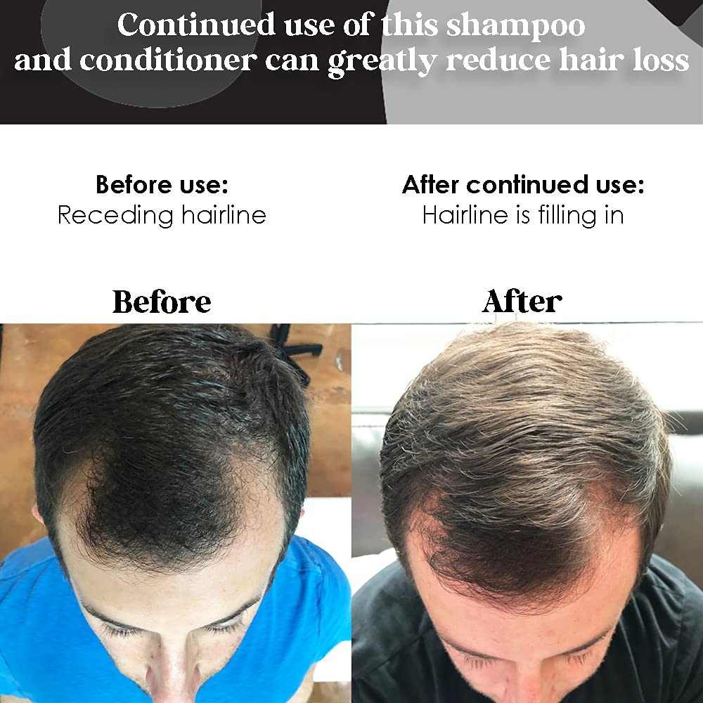 B THE PRODUCT High Potency Biotin Hair Growth Shampoo & Conditioner Set - Fortified with Vitamins E, A, C & B for Fastest Hair Growth (8.5oz.) Beauty & Personal Care B THE PRODUCT