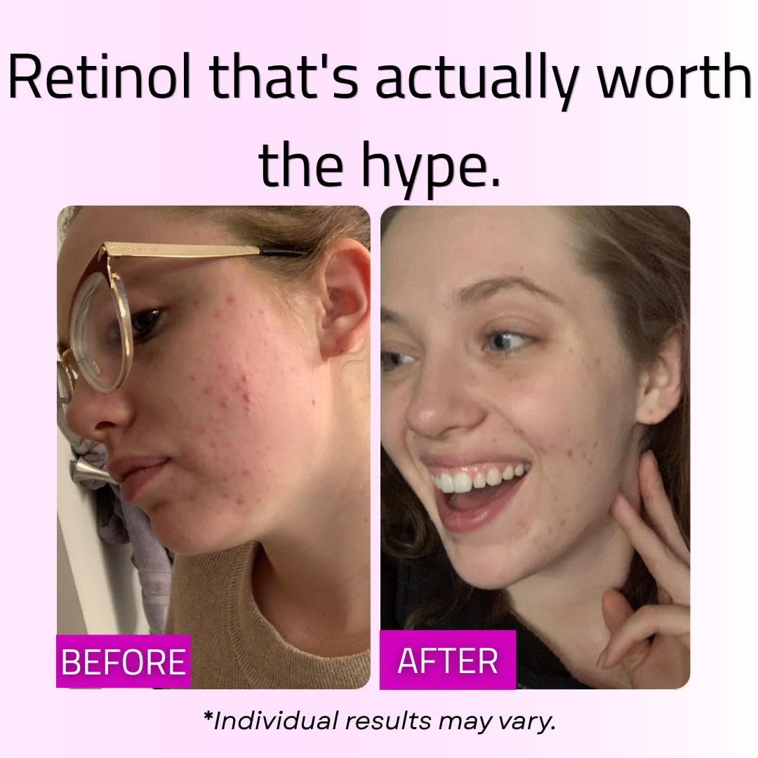 GLEOW Retinol Serum for Face with Hyaluronic Acid and Vitamin E, Gentle Retinol Face Serum Targets the Appearance of Fine Lines and Wrinkles, 2oz Beauty & Personal Care GLEOW