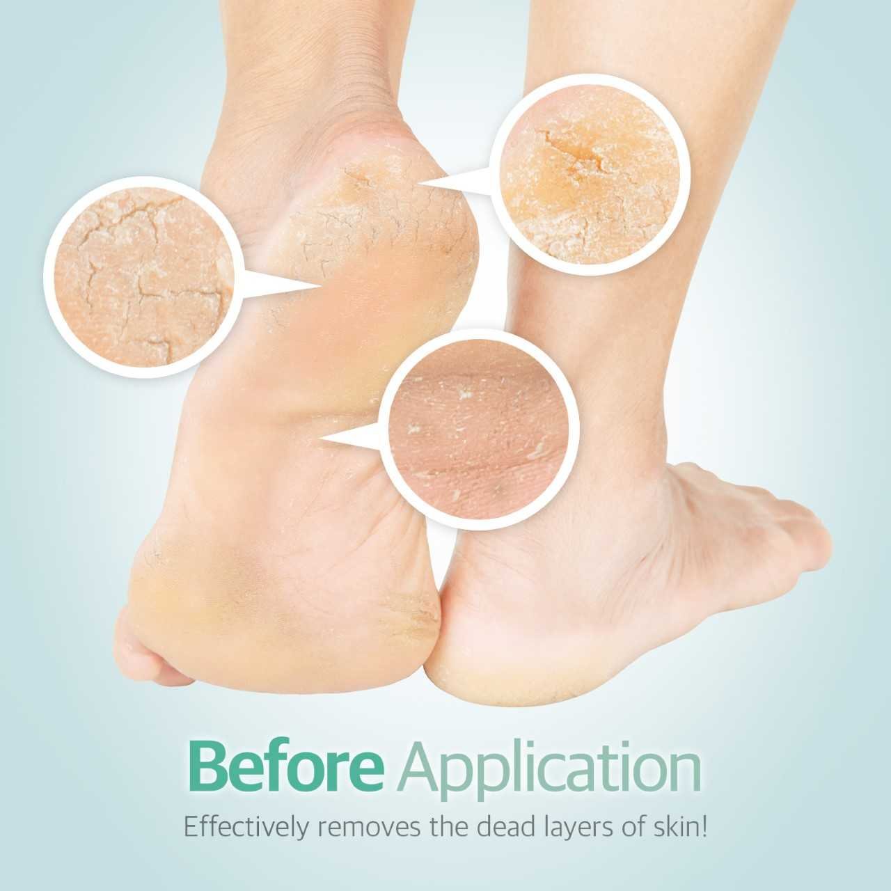 Foxi Fresh 2-Sided Diamond Coated Foot Scrubber Callus Remover Foot File Foot Care Beauty & Personal Care Foxi Fresh