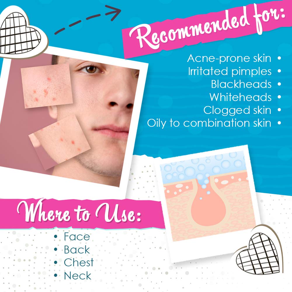 Bye Bye Blemish Acne Drying Lotion, On-the-Spot Pimple Treatment, Reduce Pimples Overnight, Beauty Skincare Essential - 1oz. (2-Pack) Beauty & Personal Care Bye Bye Blemish