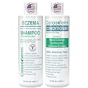 Eczema Cream Shampoo and Conditioner Scalp Treatment for Sensitive Skin for Kids & Adults- Colostrum & Colloidal Oatmeal -Itchy Scalp Anti Dandruff Beauty & Personal Care Colosderm