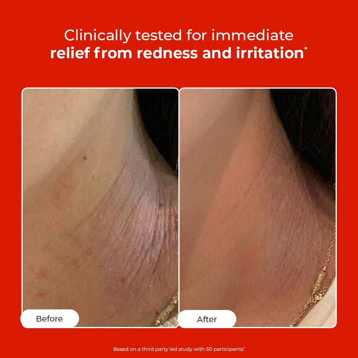 Conscious Chemist HOCL Skin Relief Face & Body Spray Soothing & Repairing Toner Hypochlorous Acid Mist for Quick Relief from Body Odour,Acne, Redness Beauty & Personal Care Conscious Chemist