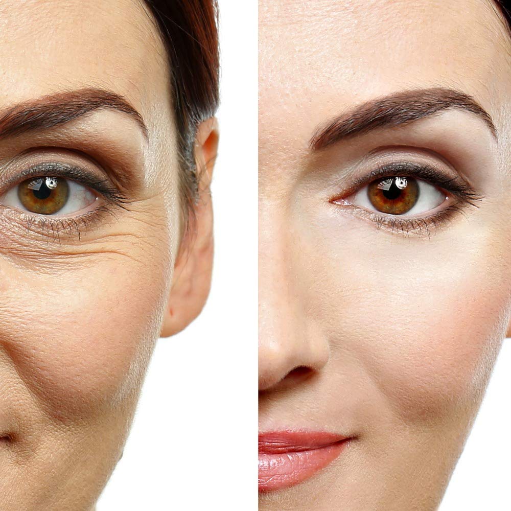 Eye Gel, for Dark Circles, Puffiness, Wrinkles, Skin Firming and Bags - Effective Anti-Aging Eye Gel for Under and Around Eyes including Crows Feet Beauty & Personal Care Essence Of Arcadia