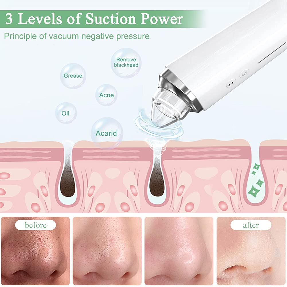 Blackhead Remover Pore Vacuum, ?[FDA Certification] ? WiFi Visible Facial Pore Cleanser with HD Camera Pimple Acne Comedone Extractor Kit with 6 Beauty & Personal Care prabensei