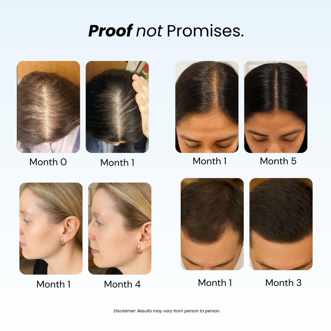 Growplex Revive Shampoo & Replenish Conditioner Bundle, Biotin Scalp Care System for Men & Women, Supports Fuller Thicker-Looking Hair Daily Beauty & Personal Care GROWPLEX