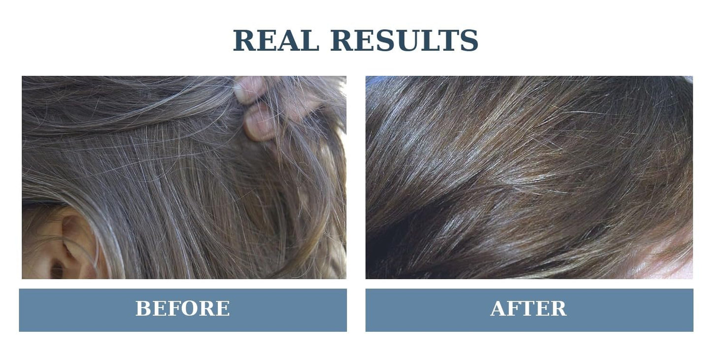 Gray Riddance Natural Hair Dye Color Spray - Vegan, Cruelty-Free, Ammonia-Free, Non-Toxic, Permanent, Brown Hair Color - 100% Gray Coverage Beauty & Personal Care Gray Riddance