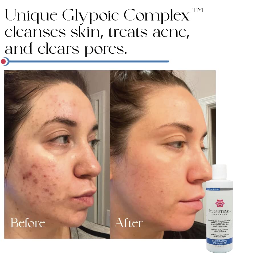 Rx Systems PF Reparative Facial Cleanser 8 oz, Repairs Skin, Clears away Oil and Dirt Build Up, Prevents Acne and Clogged Pores Beauty & Personal Care Rx Systems