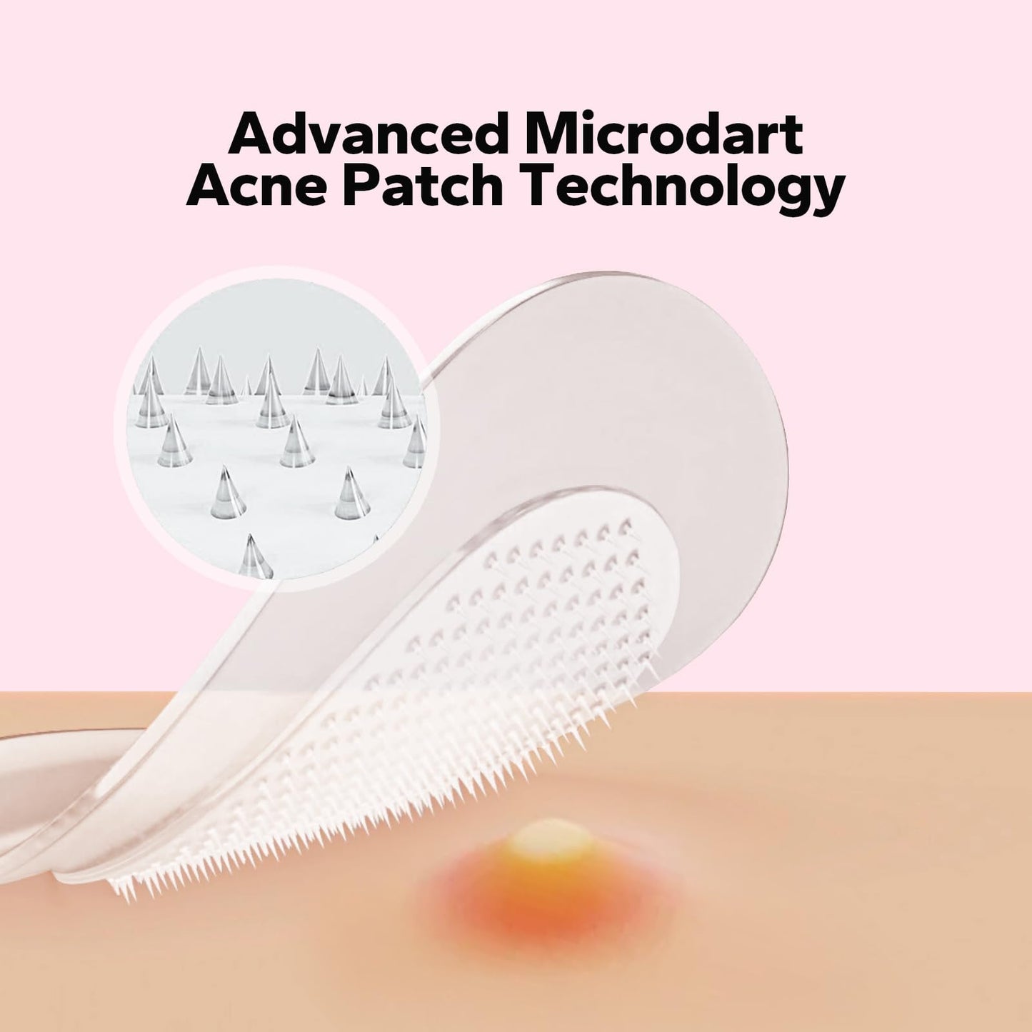 CharmCherry Pimple Patches for Face (18 Count), Microdart Acne Patches, Hydrocolloid Blemish Spot with Salicylic Acid, Fast-Acting for Early Stage Beauty & Personal Care CharmCherry