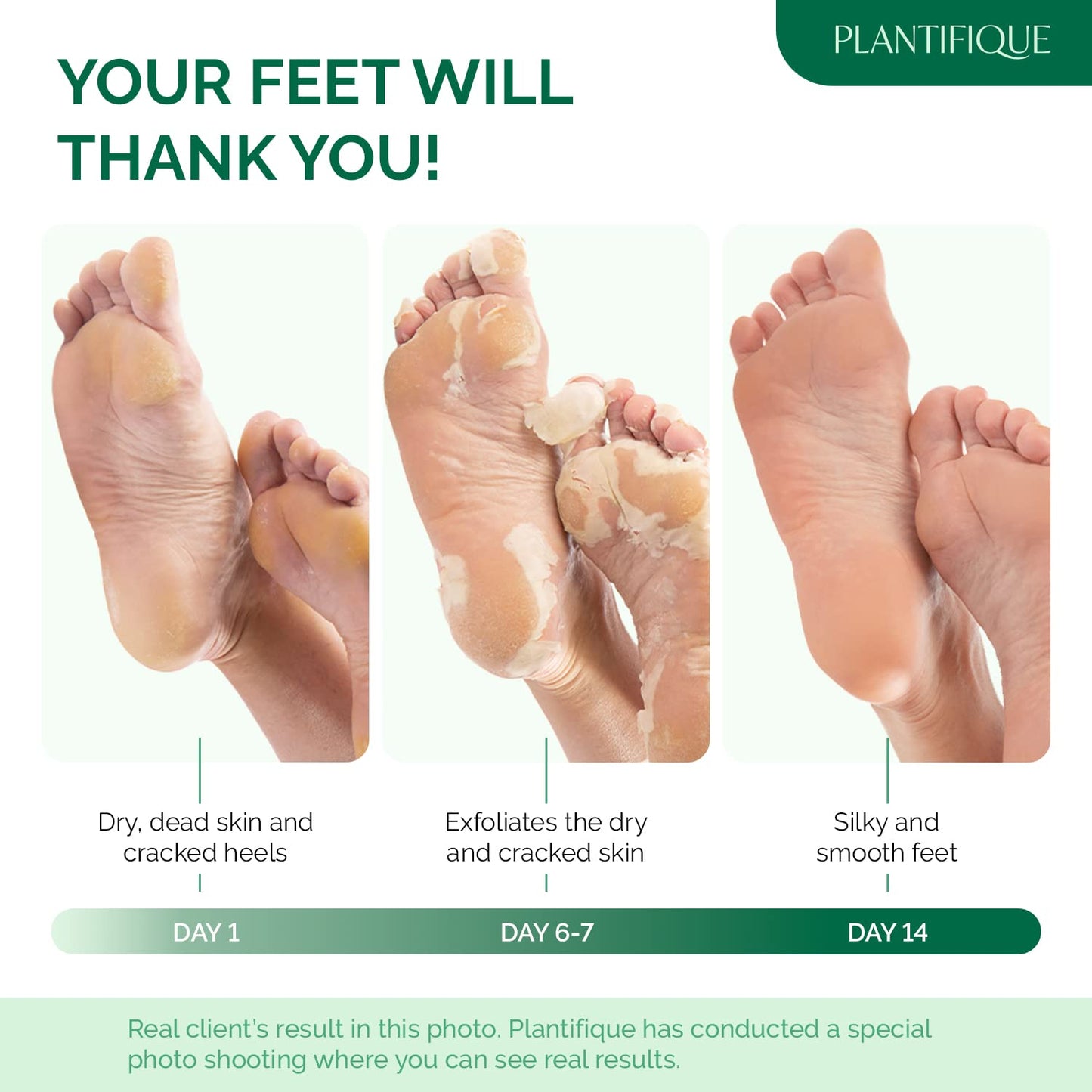 PLANTIFIQUE Foot Peeling Mask 2 Pack for Men | Dermatologically Tested Repairs Heels & Removes Dry Dead Skin for Baby Soft Feet | Exfoliating Foot Beauty and Personal Care PLANTIFIQUE