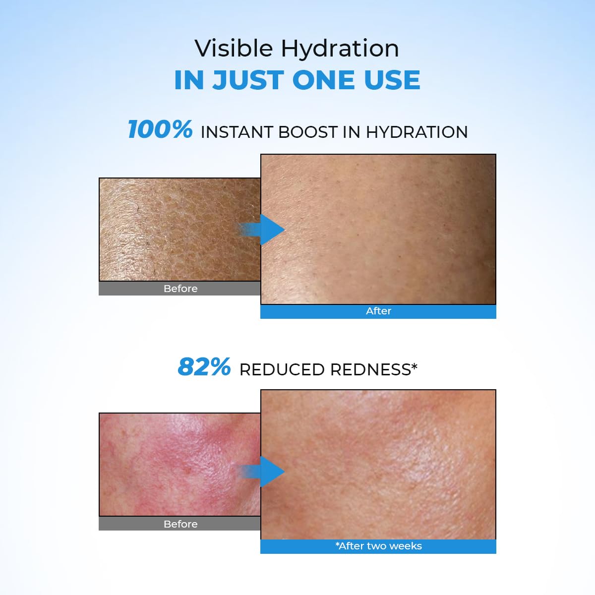 Conscious Chemist™ Hyaluronic Acid Face Gel with Ceramides | Lightweight Gel Cream| Plumps & Hydrates | For Dull & Dehydrated Skin | Fragrance Free Beauty & Personal Care Conscious Chemist