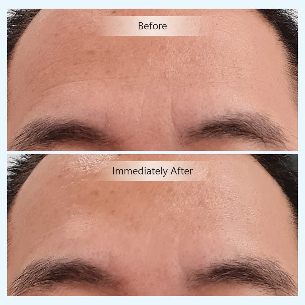 Youth Activating Instant Filler Beauty & Personal Care INVITY