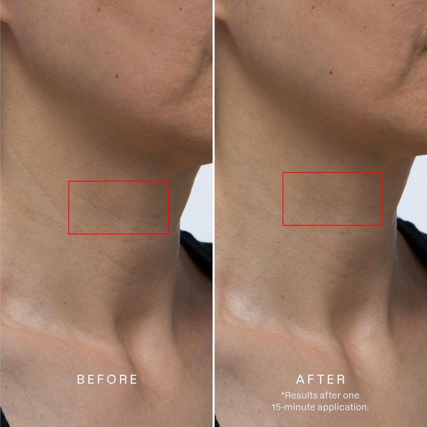 Karuna Collagen Neck & Chest Hydrogel Mask 1-Pack | Firming & Hydrating K-Beauty Masks with Collagen, Peptides & Niacinamide | For Wrinkles & Sagging Beauty & Personal Care Karuna