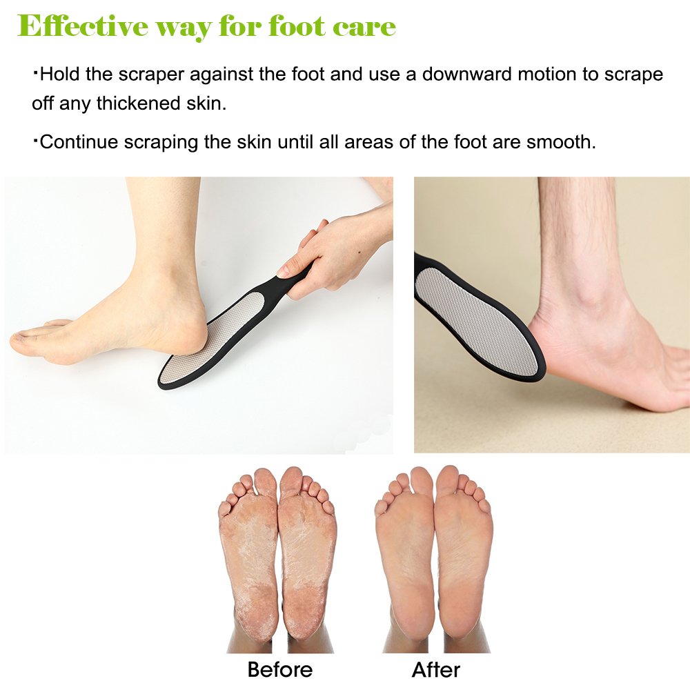 BEZOX Foot File (1 PCS), Double Sided Foot Scraper Callus Remover, Foot Rasp for Cracked Heel and Foot Corn Removal, Stainless Steel Pedicure File Beauty & Personal Care BEZOX