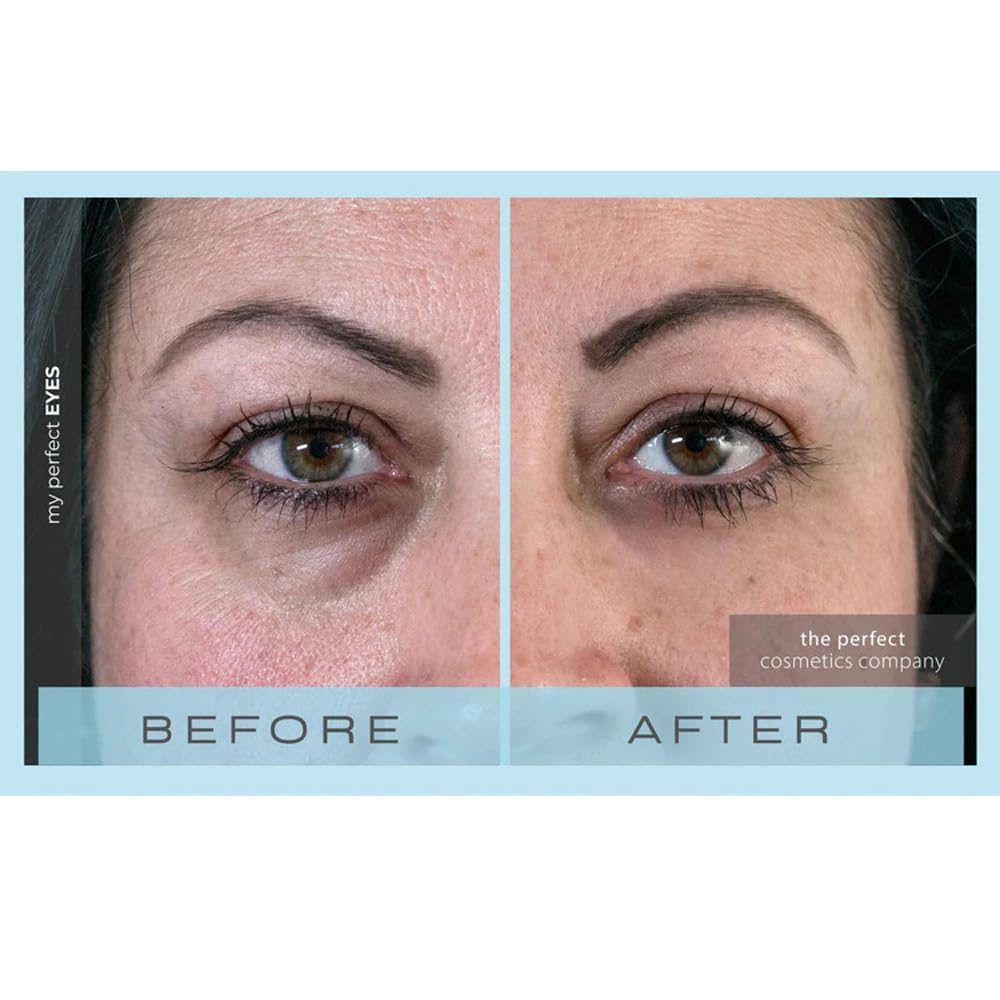 My Perfect Eyes by Penny Lane | Anti-Aging Eye Cream for Dark Circles & Puffiness | Instant Firming Treatment for Wrinkles & Fine Lines | Undereye Beauty & Personal Care My Perfect