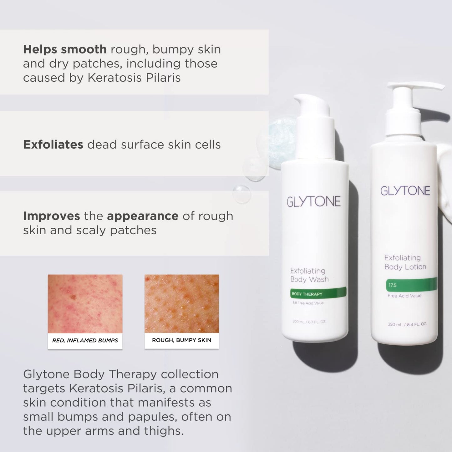Glytone Exfoliating Body Wash - 8.8 Free Acid Value Glycolic Acid - Keratosis Pilaris - Smooth Rough & Bumpy Skin - Oil & Fragrance-Free - 6.7 fl. oz. Beauty & Personal Care GLYTONE