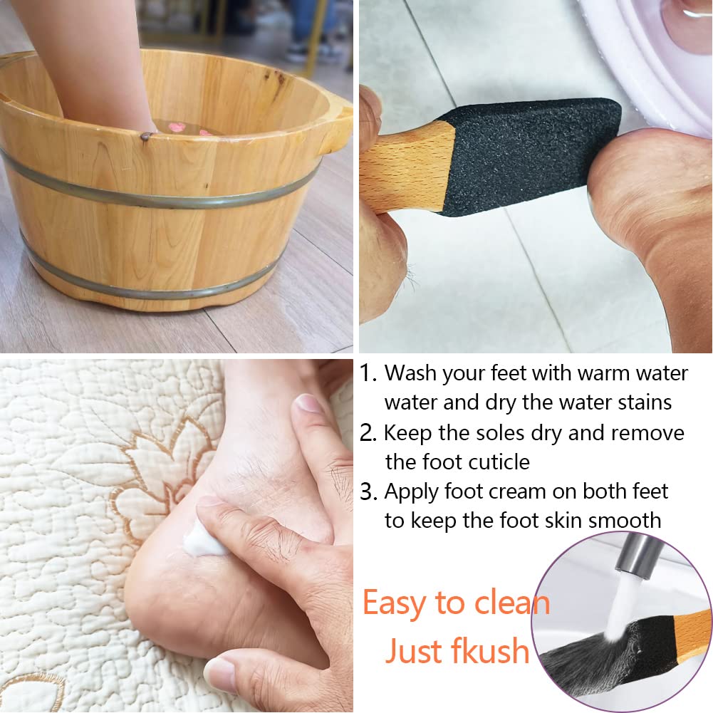 TOPMEET Foot File/Rasp,Exfoliator Pedicure Tool Foot Callus Remover Scrubber for Dead Skin,Corn and Hard Skin - Pumice Stone for Cracked Feet,Heels Beauty & Personal Care TOPMEET