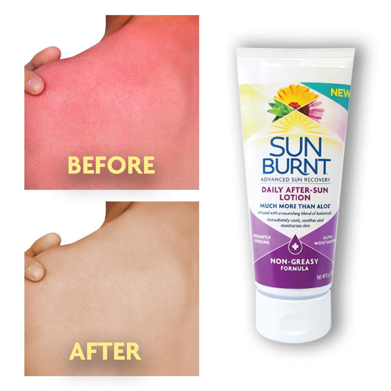 Sunburnt Advanced After-Sun Lotion, 6 Ounce Beauty & Personal Care Sunburnt