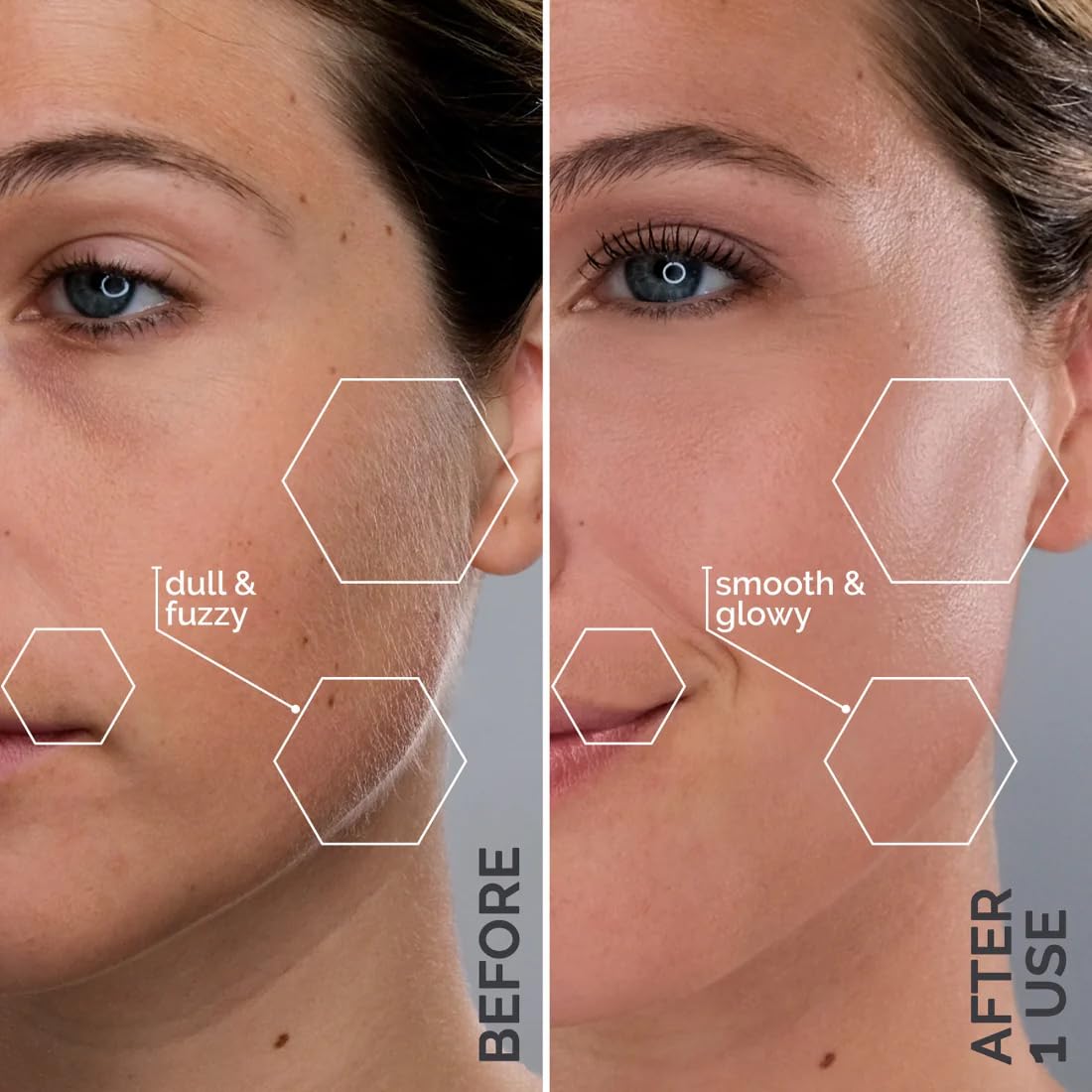 Michael Todd Beauty - Sonicsmooth Pro+ Dermaplaning Blade Refills - 8 Dermaplaning Blades- 2 Month Supply - Device Not Included Beauty & Personal Care MICHAEL TODD