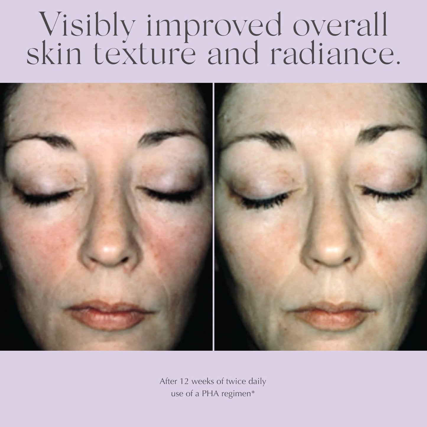 EXUVIANCE Overnight Transformation Complex Hydrating Night Cream with Hyaluronic Acid, Non-Comedogenic 50 g. Beauty & Personal Care EXUVIANCE