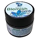 Diva Stuff Best Blemish Bomb Spot Treatment, Anti-acne spot treatment cream for Men and Women, 1/4 oz (Made in the USA) Beauty & Personal Care Diva Stuff