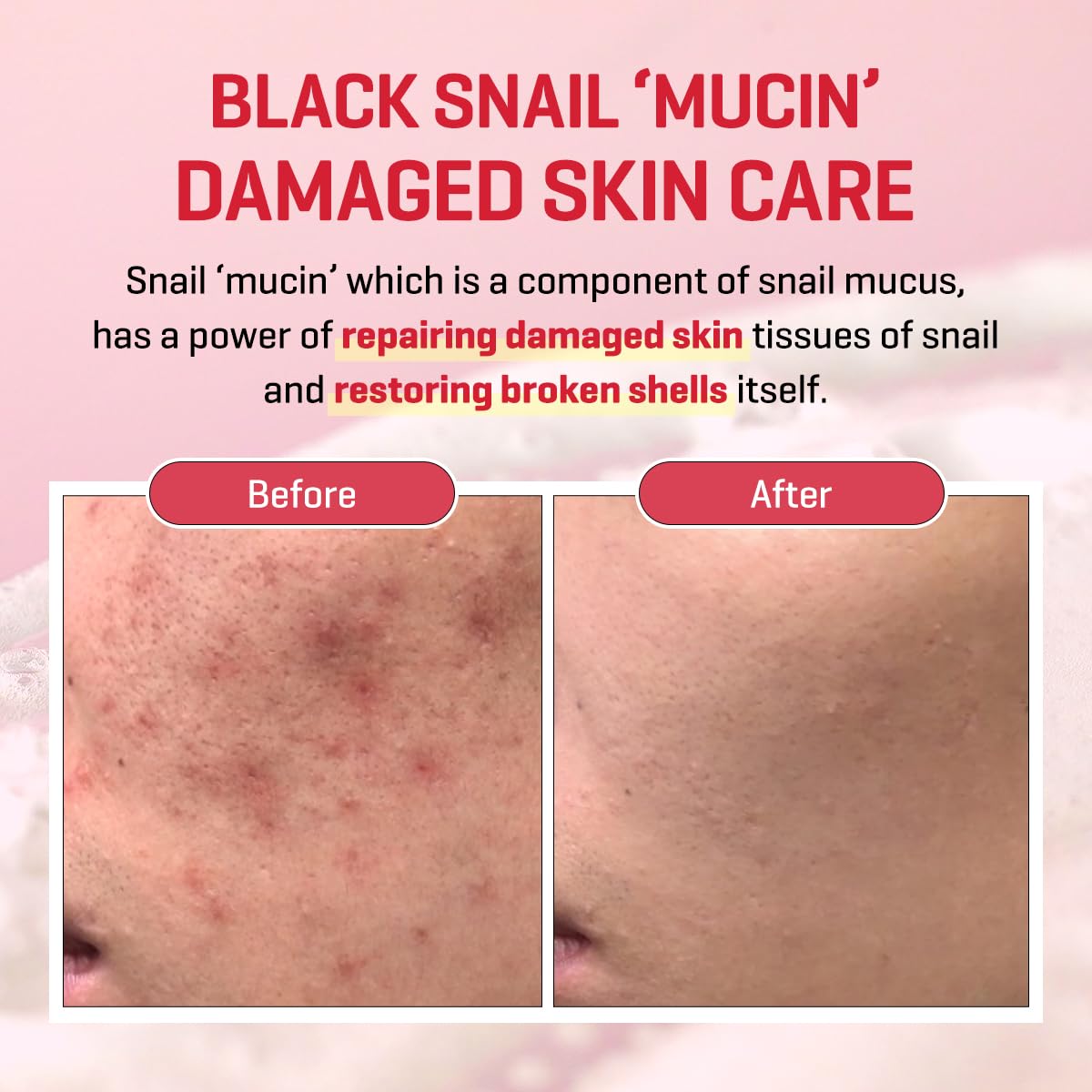 SOME BY MI Snail Truecica Miracle Repair Cream - 2.02Oz, 60ml - Made from Snail Mucin for Sensitive Skin - Daily Repair Face Moisturizer for Acne Beauty & Personal Care SOME BY MI