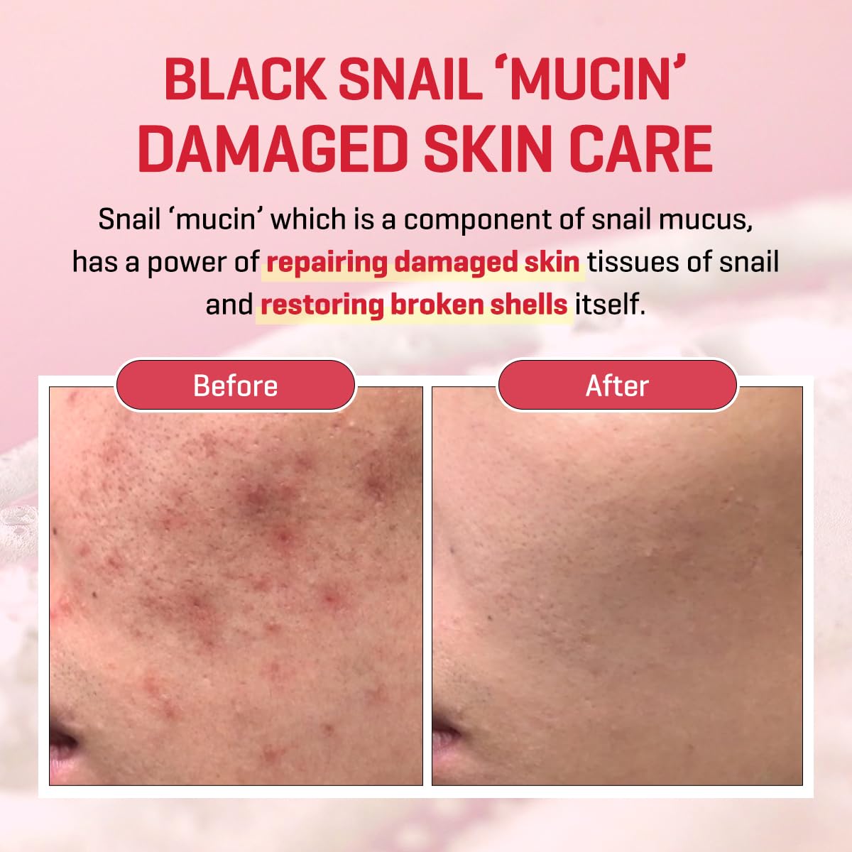 SOME BY MI Snail Truecica Miracle Repair Low pH Gel Cleanser - 3.38Oz, 100ml - Made from Snail Mucin for Sensitive Skin - Daily Face Wash for Deep Beauty & Personal Care SOME BY MI