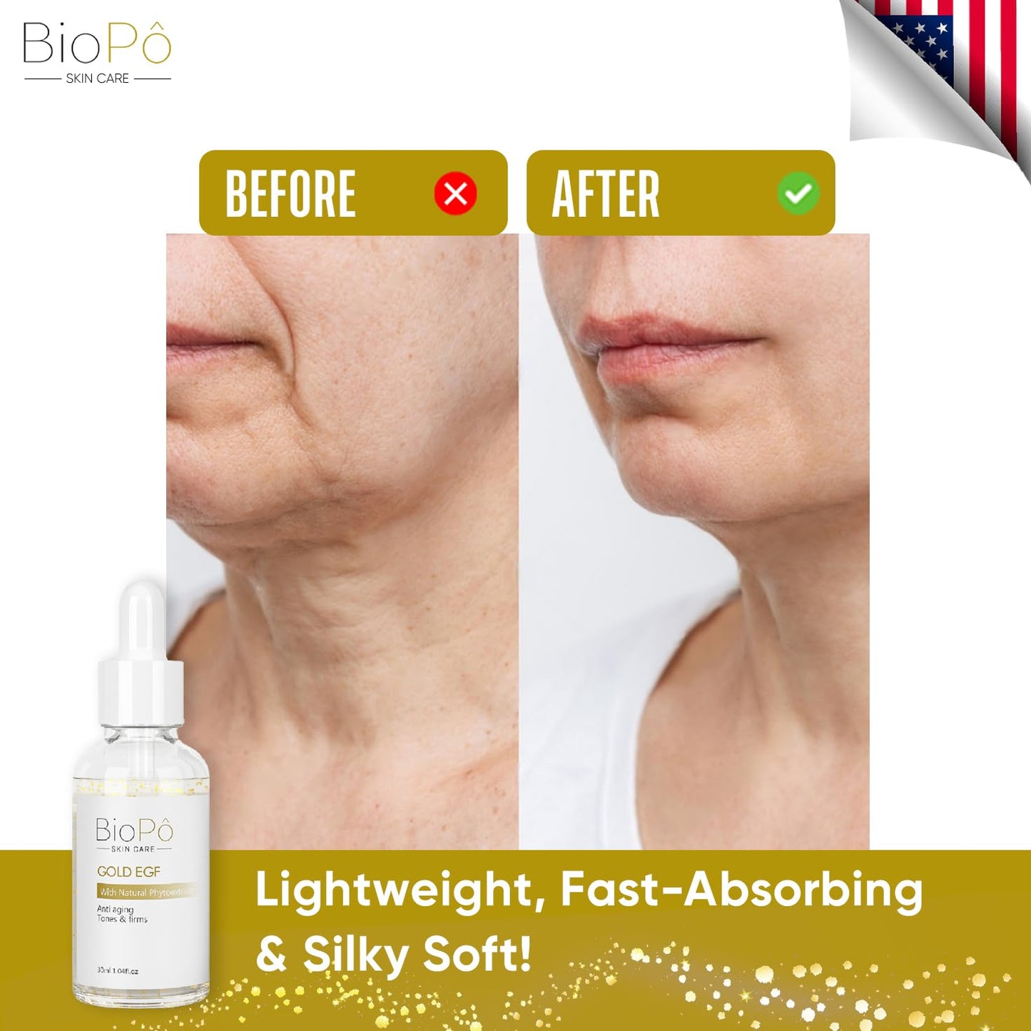 Gold EGF - Anti-Wrinkle Face Treatment for Firming Skin Texture, Promotes Cell Regeneration & Nourishment, 30 ml - Made in USA Beauty & Personal Care BioPo