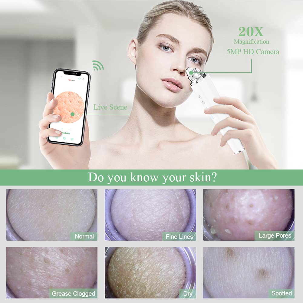 Blackhead Remover Pore Vacuum, ?[FDA Certification] ? WiFi Visible Facial Pore Cleanser with HD Camera Pimple Acne Comedone Extractor Kit with 6 Beauty & Personal Care prabensei