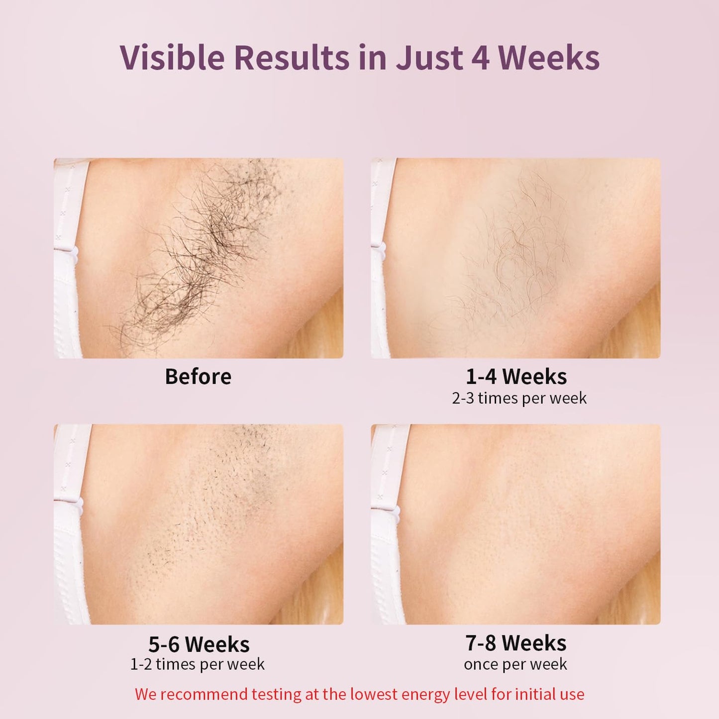 MLAY IPL Laser Hair Removal, Hair Removal Device with Ice Cooling Painless Hair Removal for Women & Men, Permanent Hair Removal at Home for Arms Beauty and Personal Care MLAY