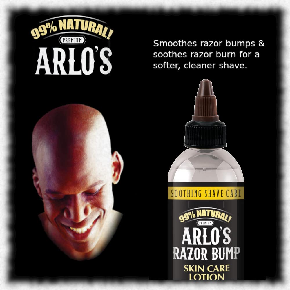 Arlo's Razor Bump Skin Care Lotion 6 oz. Beauty & Personal Care Arlo's