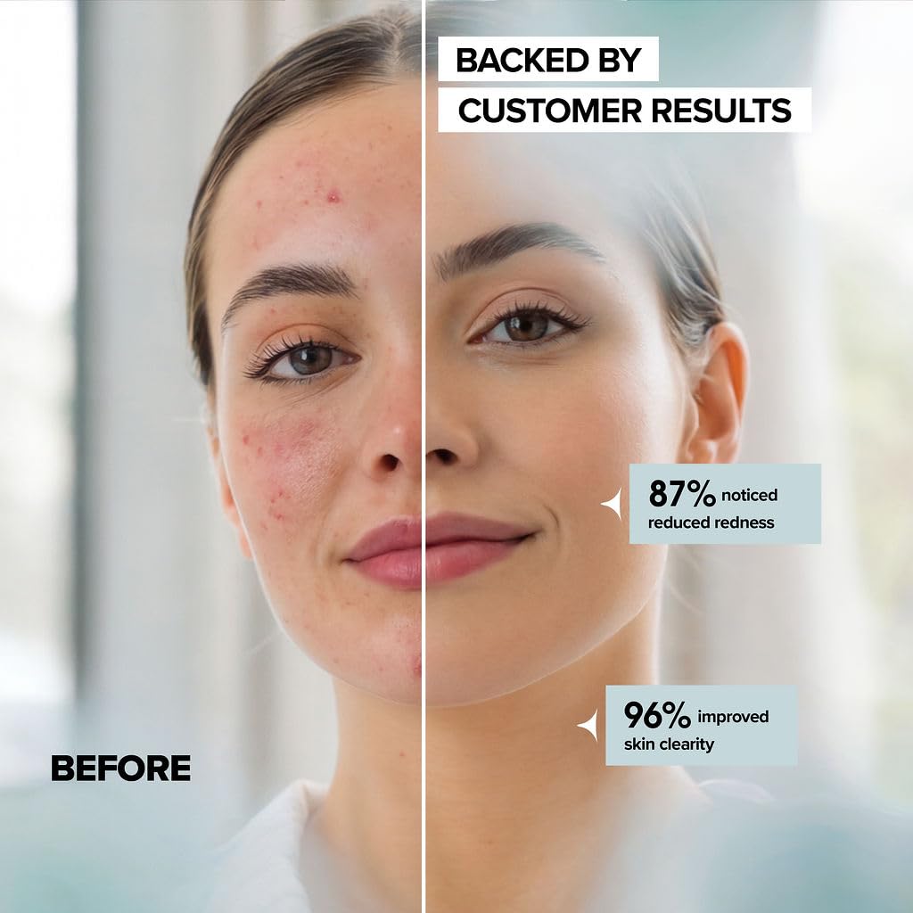 Face Towels - Ultra Soft and Thick Disposable Face Towelettes for Women - Biodegradable Facial Towels for Sensitive Skin - Face Cleansing, Makeup Beauty & Personal Care lebogner