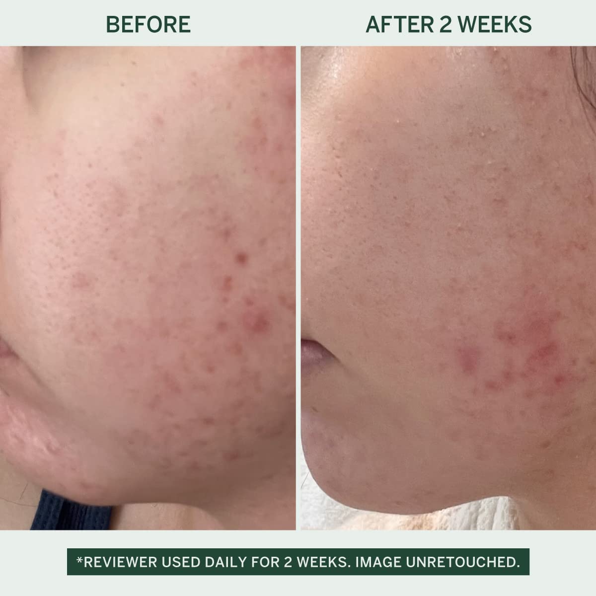 FACETORY Urban Calm Hydrating Vita Serum with Fermented Mung Bean & 10% Niacinamide, Glow Boosting Facial Serum for Women, Brightening, Fine Line Beauty & Personal Care FACETORY