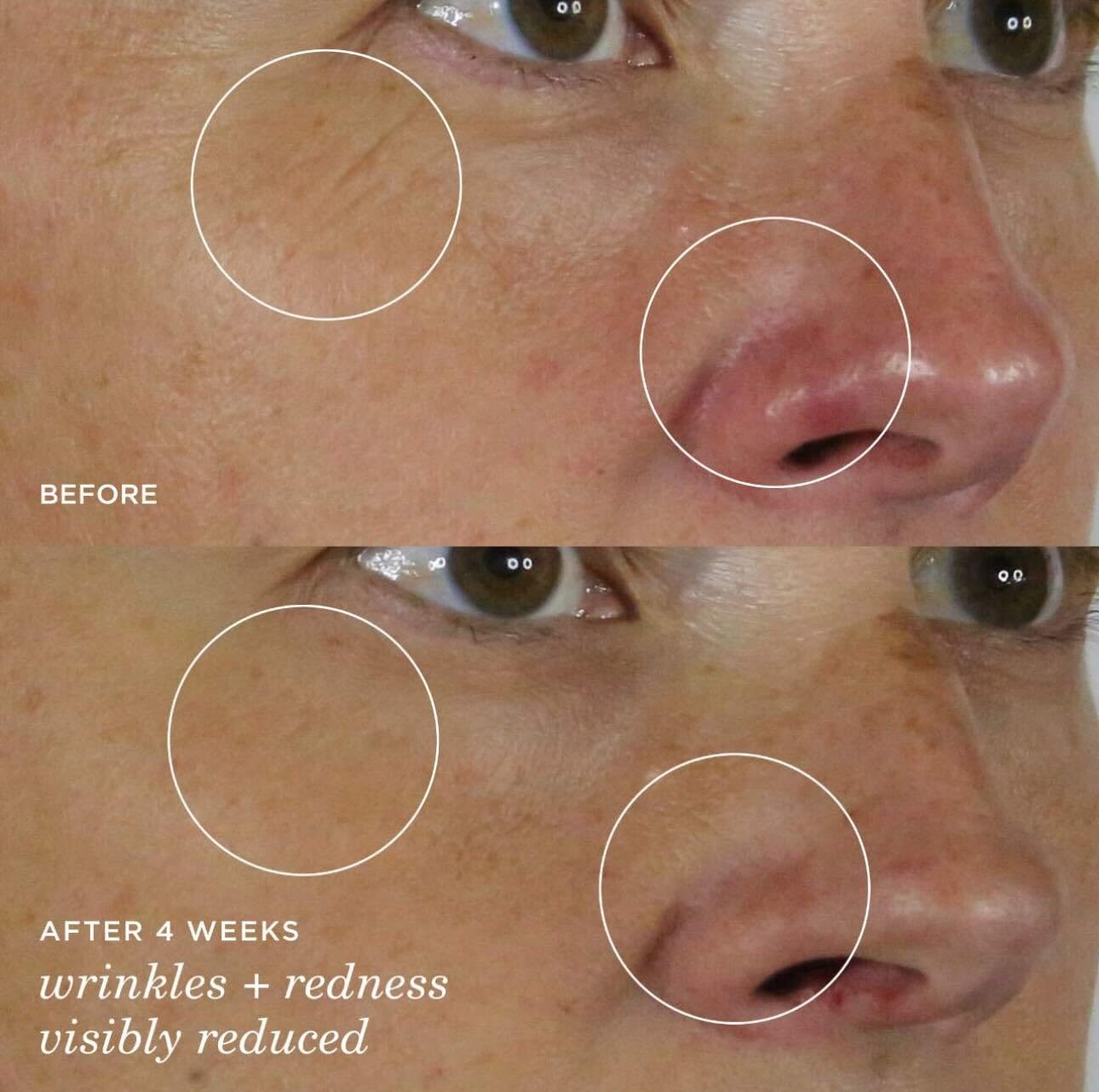 Tatcha The Silk Serum Wrinkle-Smoothing Retinol Alternative | 30 ml / 1 oz Beauty & Personal Care TATCHA