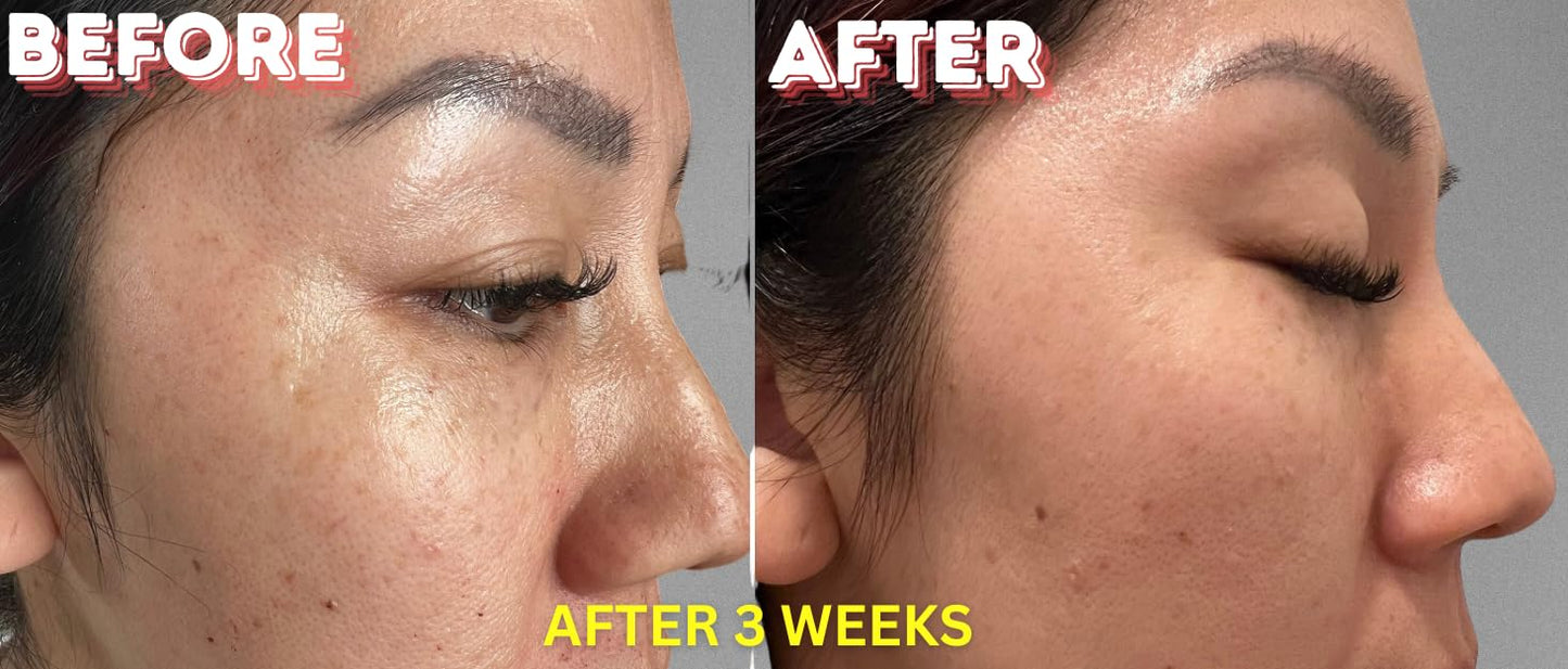 Enspri 4XPeptide Plus Serum Collagen Boosting Anti-Aging Esthetician Collagen Boost for Face, Skin Facial Smooth Wrinkles and Fine Lines Skincare Beauty & Personal Care Enspri