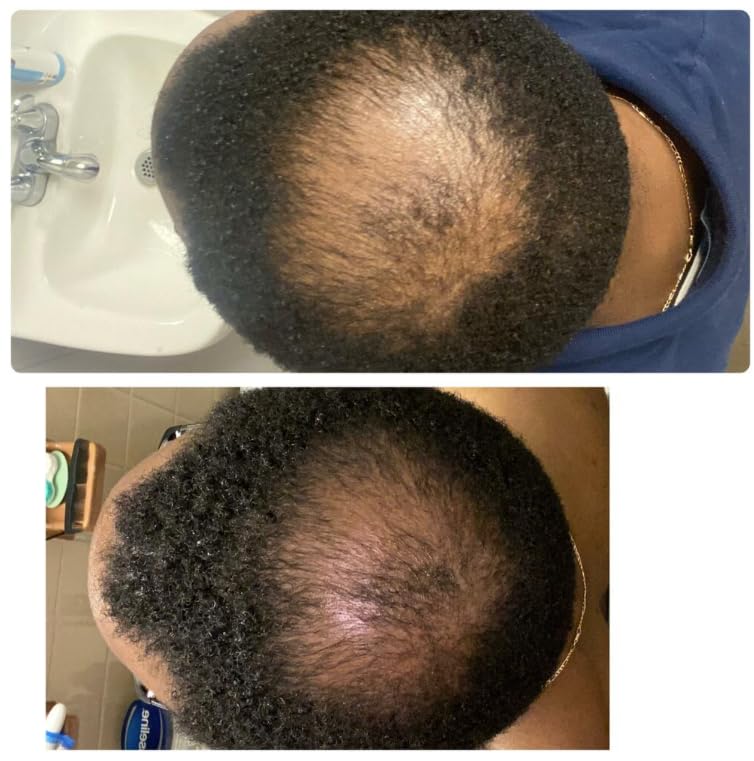 Kreyol Essence - 8 Oz DEEP CONDITIONER MASK, Scalp Care Reduce Shed + Repair Hair Mask, Overnight Moisture Mask