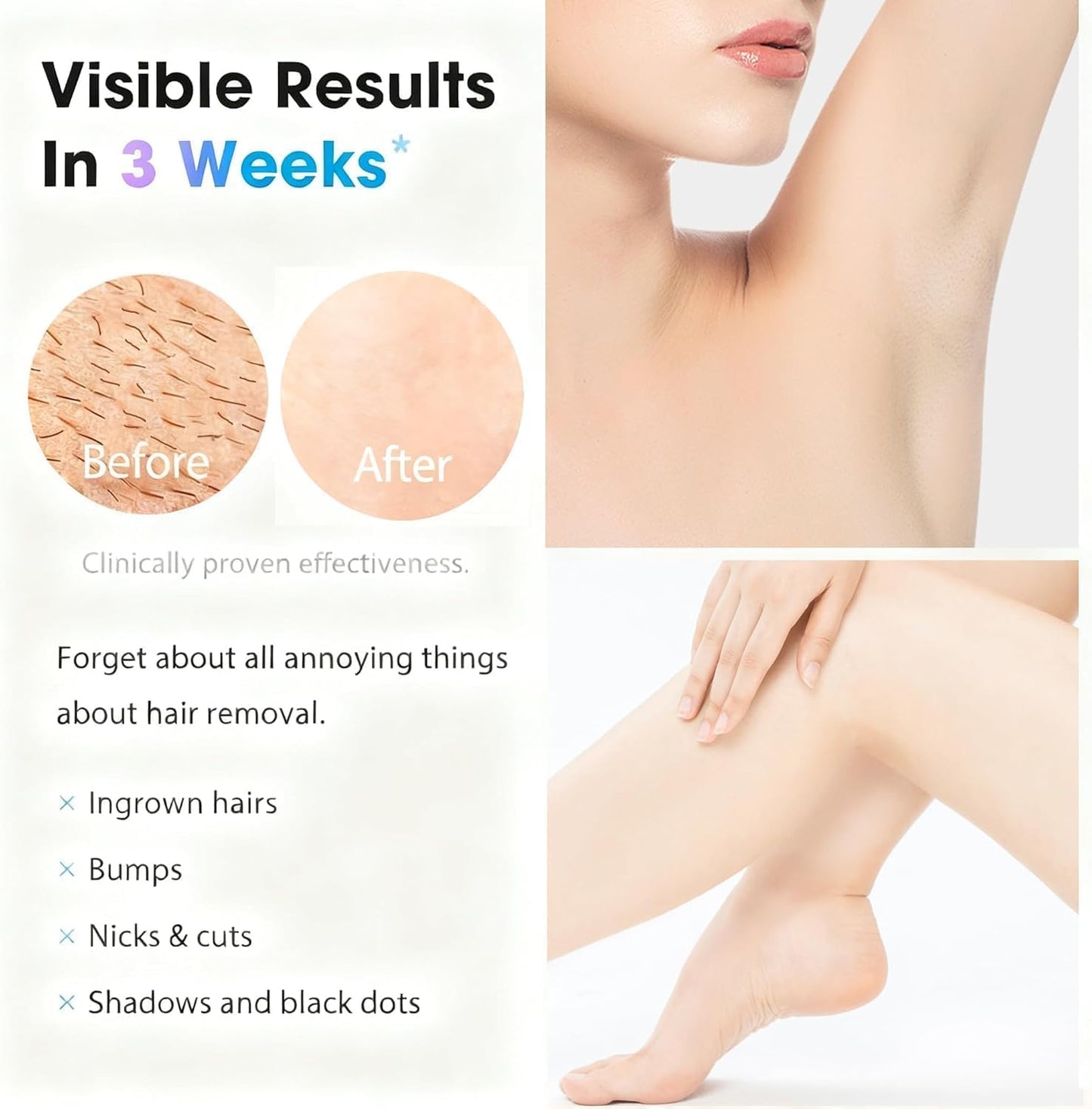 IPL Laser Hair Removal Device for Women and Men - Permanent Painless 90% Hair Reduction in 4 Weeks, Whole Body Use (Armpits, Bikini Line, Face, Legs Beauty and Personal Care Gransumr