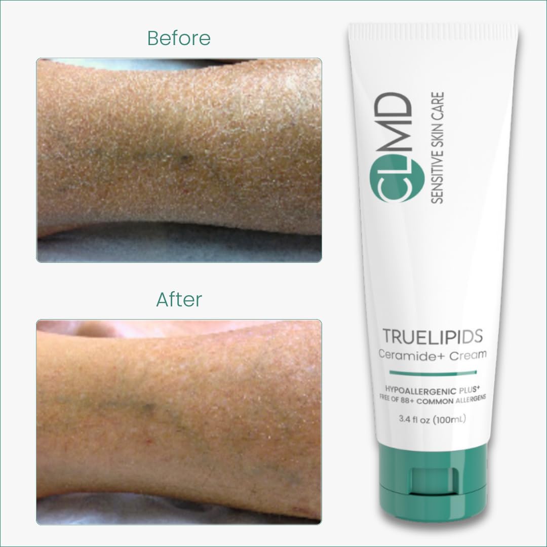 CLMD TrueLipids Ceramide+ Cream - Deep Moisturizing Barrier Support for Sensitive Skin - Hydrates and Soothes - Hypoallergenic, Nourishing Beauty & Personal Care Cheryl Lee M.D.