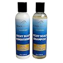 Itchy Scalp Shampoo & Conditioner Set, 8 oz Each, African Black Soap Shampoo, Dandruff shampoo & Conditioner, All-Natural Treatment, Dry & Itchy Scalp Beauty & Personal Care Roses Natural