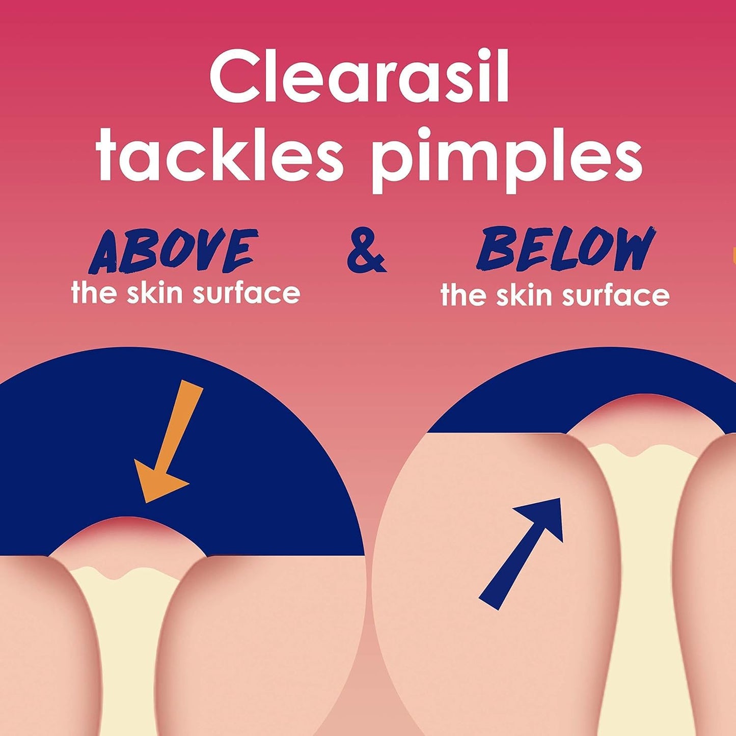 Clearasil Rapid Rescue Deep Treatment Wash, 6.78 oz Each (Pack of 12) Beauty & Personal Care Clearasil
