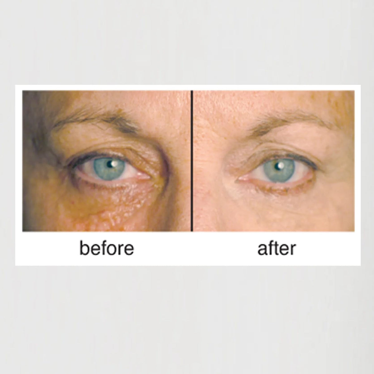 Clientele Peptide Wrinkle Concealer Compact Neutral Beauty & Personal Care Clientele