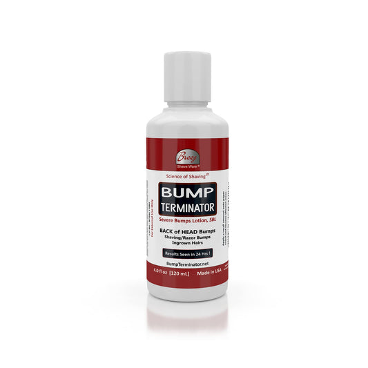 BREEJ Bump Terminator Severe Bumps Lotion (4oz) Beauty and Personal Care BREEJ