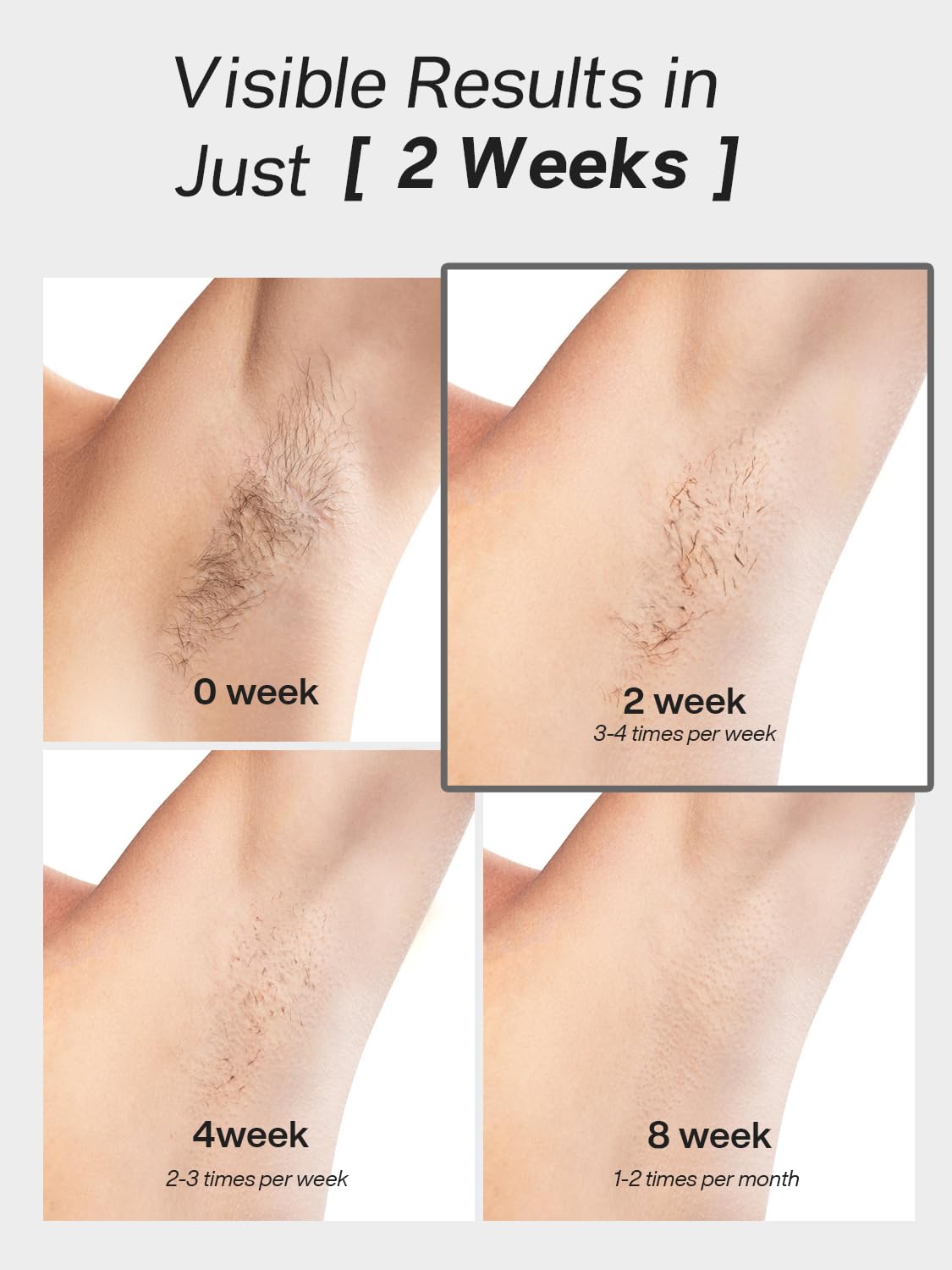 Blex Laser Hair Removal for Women and Men, IPL Hair Removal Device Effective in 2 Weeks, with Ultra-Fast 0.2s Light Emission, Comfortable Beauty and Personal Care Blex