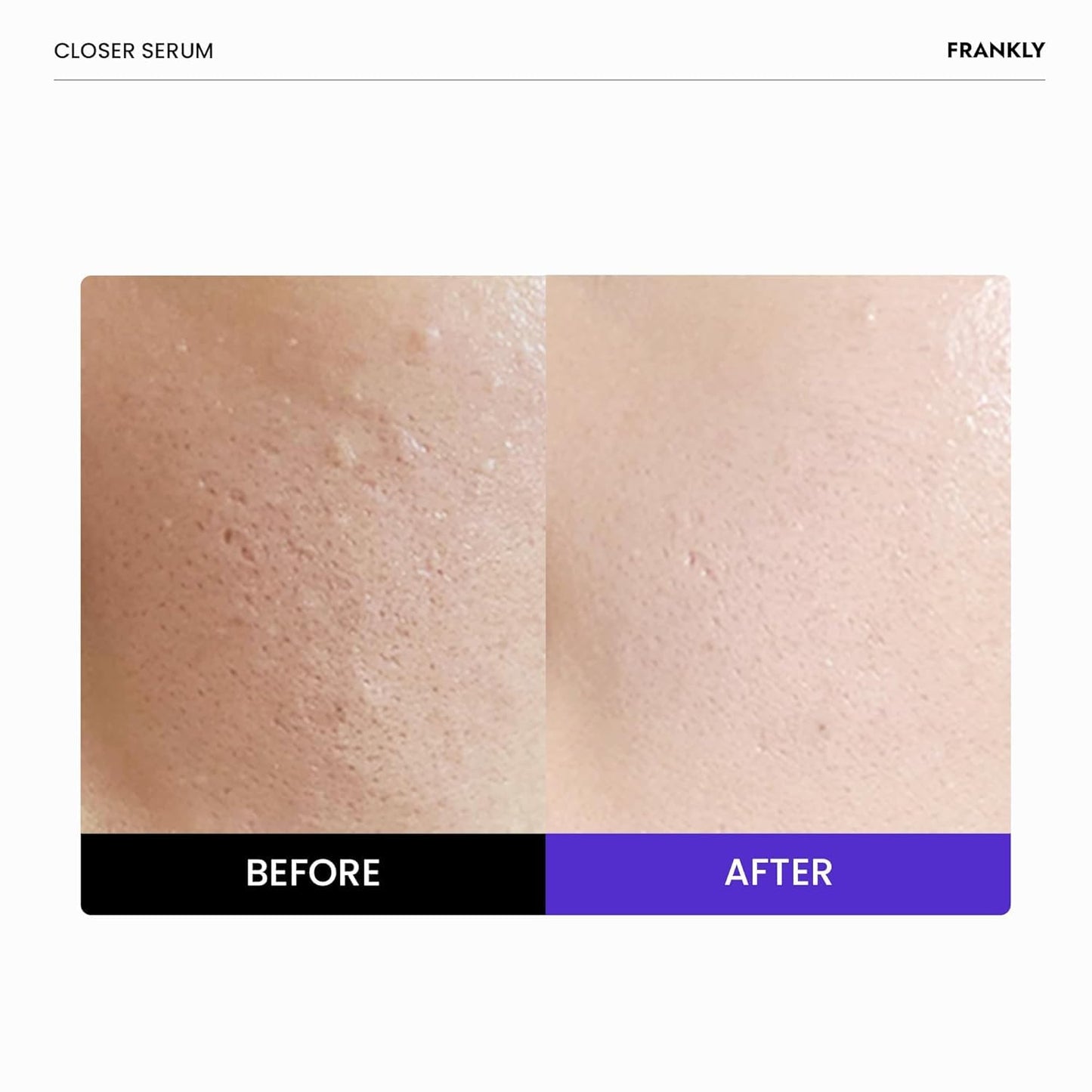 FRANKLY Closer Serum Mega Jumbo | Pore Minimizer Serum | 9 Peptides, Vegan Collagen, Adenosine, PHA | Korean Pore Minimizer for Glass Skin Beauty and Personal Care FRANKLY